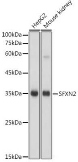 SFXN2 Antibody - Azide and BSA Free, Novus Biologicals 0.02 mL; Unconjugated:Antibodies,