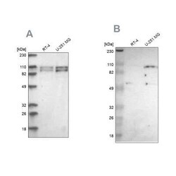 SG2NA Antibody, Novus Biologicals:Antibodies:Primary Antibodies