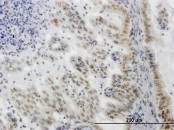 SGK1 Antibody (3C4), Novus Biologicals 0.1 mg | Buy Online | Novus Biologicals | Fisher Scientific