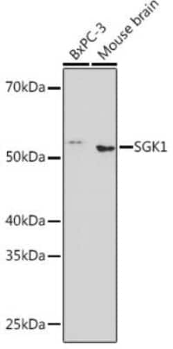 SGK1 Rabbit anti-Human, Mouse, Clone: 3P4N3, Novus Biologicals 100 &mu;g | Buy Online | Novus Biologicals | Fisher Scientific