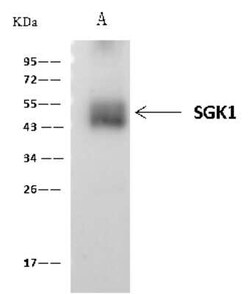 SGK1 Antibody, Novus Biologicals 100 &mu;g, Unconjugated:Antibodies, Polyclonal