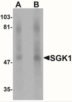SGK1 Antibody - BSA Free, Novus Biologicals 0.1 mg; Unconjugated:Antibodies,