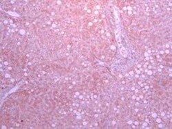 SGLT1/SLC5A1 Antibody, Novus Biologicals 0.1 mg | Buy Online | Novus Biologicals | Fisher Scientific