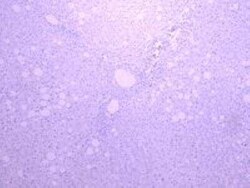 SGLT1/SLC5A1 Antibody, Novus Biologicals 0.1 mg | Buy Online | Novus Biologicals | Fisher Scientific