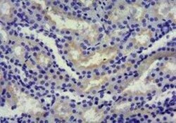 SGLT1/SLC5A1 Antibody, Novus Biologicals 0.1 mg | Buy Online | Novus Biologicals | Fisher Scientific