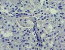 SGLT1/SLC5A1 Antibody, Novus Biologicals 0.1 mg | Buy Online | Novus Biologicals | Fisher Scientific