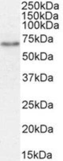 SGLT1/SLC5A1 Antibody, Novus Biologicals 0.1 mg | Buy Online | Novus Biologicals | Fisher Scientific