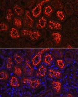 SGLT2/SLC5A2 Rabbit anti-Human, Mouse, Rat, Polyclonal, Novus Biologicals:Antibodies:Primary