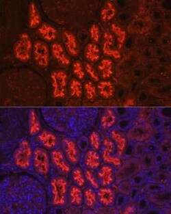 SGLT2/SLC5A2 Rabbit anti-Human, Mouse, Rat, Polyclonal, Novus Biologicals:Antibodies:Primary