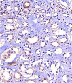 SGLT2/SLC5A2 Antibody - BSA Free, Novus Biologicals 0.1 mg, Unconjugated:Antibodies,