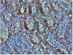 SGLT2/SLC5A2 Antibody, Novus Biologicals 100 &mu;g | Buy Online | Novus Biologicals | Fisher Scientific