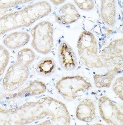 SGLT2/SLC5A2 Rabbit anti-Human, Mouse, Rat, Polyclonal, Novus Biologicals:Antibodies:Primary