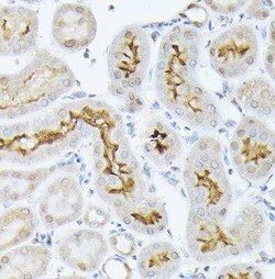 SGLT2/SLC5A2 Rabbit anti-Human, Mouse, Rat, Polyclonal, Novus Biologicals:Antibodies:Primary