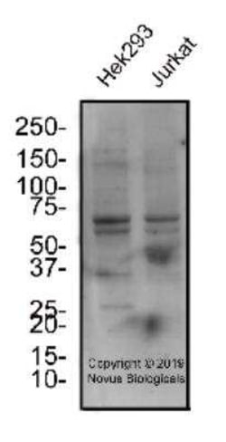 SGLT2/SLC5A2 Antibody - BSA Free, Novus Biologicals 0.1 mg, Unconjugated:Antibodies,