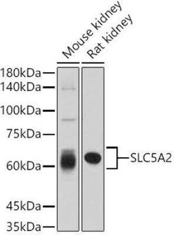SGLT2/SLC5A2 Rabbit anti-Human, Mouse, Rat, Polyclonal, Novus Biologicals:Antibodies:Primary