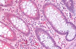 SGLT3/SLC5A4 Antibody - BSA Free, Novus Biologicals 0.05 mL | Buy Online | Novus Biologicals | Fisher Scientific