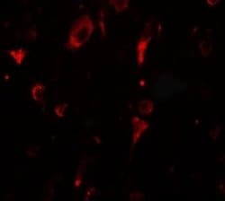 SGSM2 Antibody - BSA Free, Novus Biologicals 0.1 mg; Unconjugated:Antibodies,
