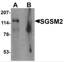 SGSM2 Antibody - BSA Free, Novus Biologicals 0.1 mg; Unconjugated:Antibodies,