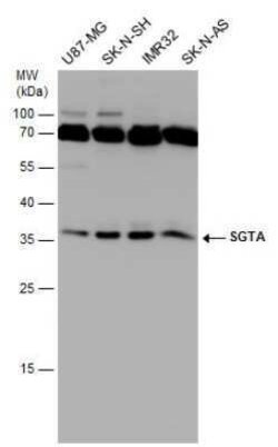 SGTA Antibody (6A4), Novus Biologicals 100 &mu;g | Buy Online | Novus Biologicals | Fisher Scientific