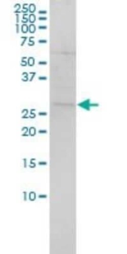 SH3BGR Antibody (3B7), Novus Biologicals 0.1 mg | Buy Online | Novus Biologicals | Fisher Scientific