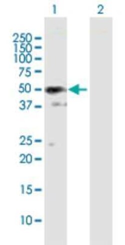 SH3GLB2 Antibody, Novus Biologicals 50 &mu;g | Buy Online | Novus Biologicals | Fisher Scientific