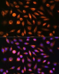 SH3PXD2A Rabbit anti-Human, Mouse, Polyclonal, Novus Biologicals 100 &mu;g;