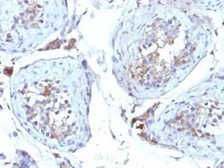 SHBG Antibody (SHBG/245), Novus Biologicals:Antibodies:Primary Antibodies