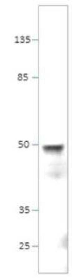 SHFM3 Antibody, Novus Biologicals 100 &mu;g | Buy Online | Bio-Techne | Fisher Scientific