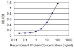 SHFM3P1 Antibody (3F1), Novus Biologicals 0.1 mg | Buy Online | Novus Biologicals | Fisher Scientific