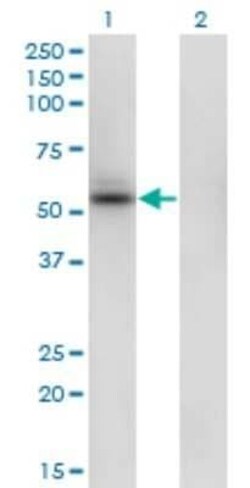 SHMT1 Antibody (4F9), Novus Biologicals 0.1 mg | Buy Online | Novus Biologicals | Fisher Scientific