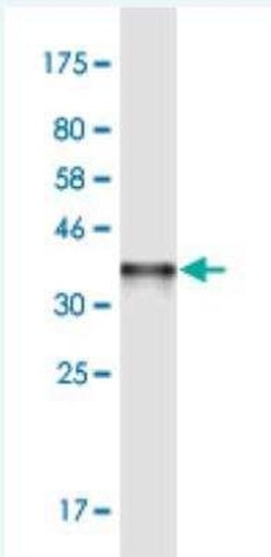 SHMT2 Antibody (5E7), Novus Biologicals 100 &mu;g | Buy Online | Novus Biologicals | Fisher Scientific