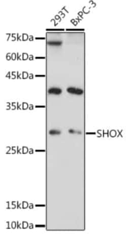 SHOX Rabbit anti-Human, Mouse, Rat, Polyclonal, Novus Biologicals 20 &mu;g;