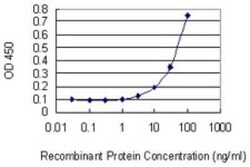 SHOX2 Antibody (1D1), Novus Biologicals 0.1 mg | Buy Online | Novus Biologicals | Fisher Scientific