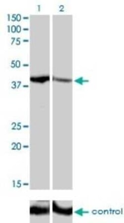 SHOX2 Antibody (1D1), Novus Biologicals 0.1 mg | Buy Online | Novus Biologicals | Fisher Scientific