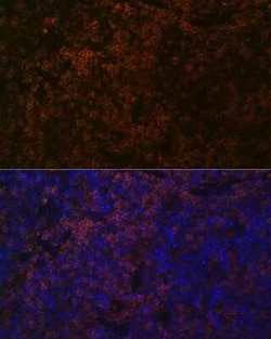 SHP-1 Rabbit anti-Human, Mouse, Rat, Clone: 7I1K3, Novus Biologicals:Antibodies:Primary