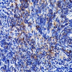 SHP-1 Rabbit anti-Human, Mouse, Rat, Clone: 7I1K3, Novus Biologicals:Antibodies:Primary