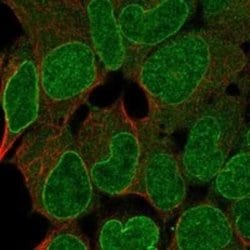 SHPRH Rabbit anti-Human, Polyclonal, Novus Biologicals 100 &mu;g | Buy Online | Novus Biologicals | Fisher Scientific