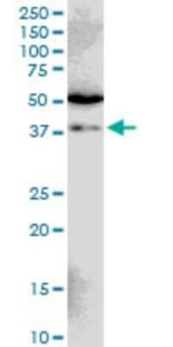 SIAH1 Antibody (2C5), Novus Biologicals 0.1 mg | Buy Online | Novus Biologicals | Fisher Scientific