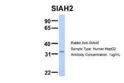 SIAH2 Rabbit anti-Human, Polyclonal, Novus Biologicals 0.1 mL; Unconjugated:Antibodies,