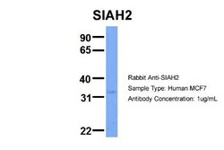 SIAH2 Rabbit anti-Human, Polyclonal, Novus Biologicals 0.1 mL; Unconjugated:Antibodies,