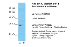 SIAH2 Rabbit anti-Human, Polyclonal, Novus Biologicals 0.1 mL; Unconjugated:Antibodies,
