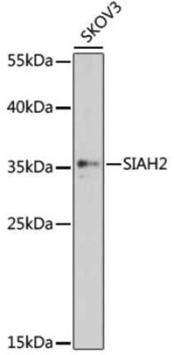 SIAH2 Antibody - Azide and BSA Free, Novus Biologicals:Antibodies:Primary
