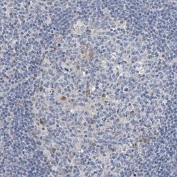 SIL1 Antibody, Novus Biologicals 25 &mu;L; Unconjugated:Anticuerpos