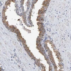 SIL1 Antibody, Novus Biologicals 25 &mu;L; Unconjugated:Anticuerpos