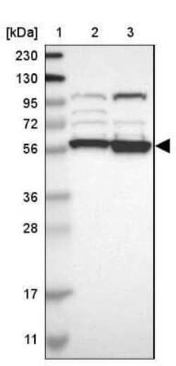 SIL1 Antibody, Novus Biologicals 25 &mu;L; Unconjugated:Anticuerpos