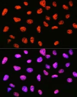 SIN3A Rabbit anti-Human, Mouse, Rat, Clone: 8V5B6, Novus Biologicals:Antibodies:Primary
