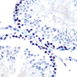 SIN3A Rabbit anti-Human, Mouse, Rat, Clone: 8V5B6, Novus Biologicals:Antibodies:Primary