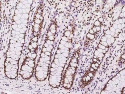 SIN3A Antibody, Novus Biologicals 100 &mu;g, Unconjugated:Antibodies, Polyclonal