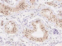 SIPA1L1 Antibody, Novus Biologicals:Antibodies:Primary Antibodies