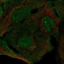 SIPA1L3 Rabbit anti-Human, Polyclonal, Novus Biologicals:Antibodies:Primary